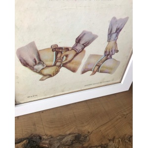 Medical And Military Vintage Original Poster On Card
