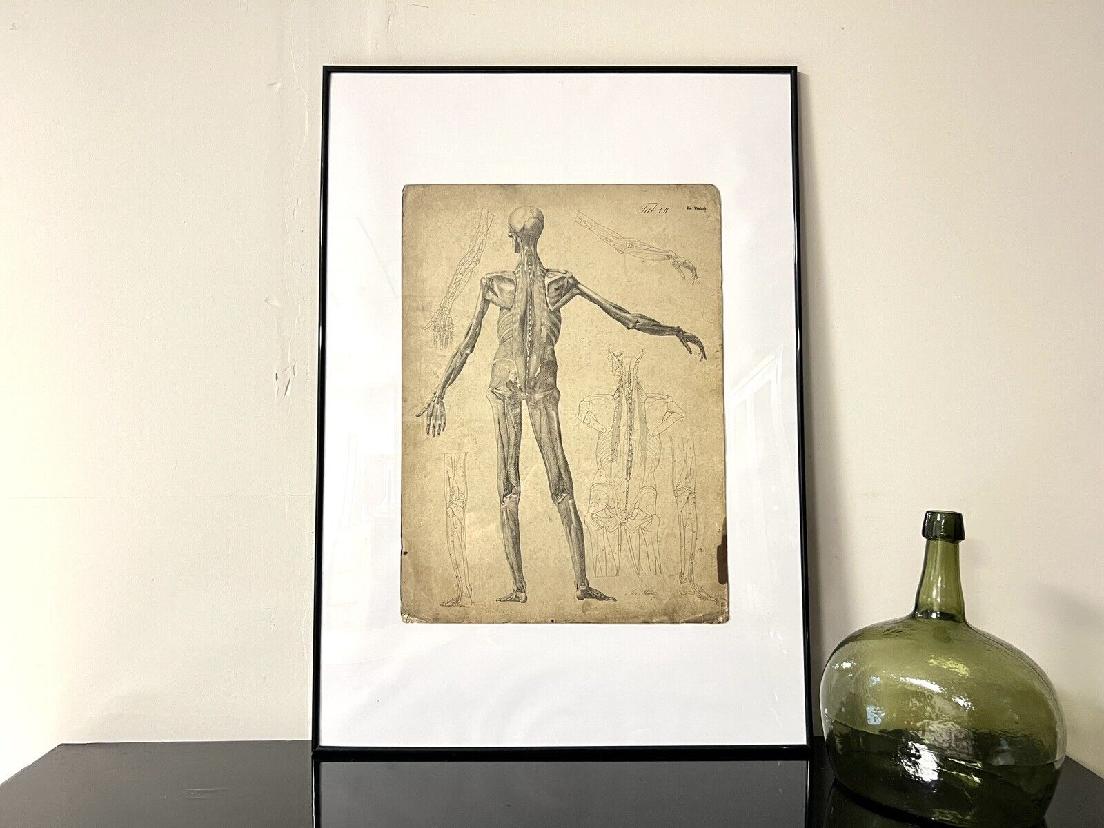 Dr Munz Fecit, A 19th Century Anatomical Etching