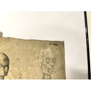 Dr Munz Fecit, A 19th Century Anatomical Etching