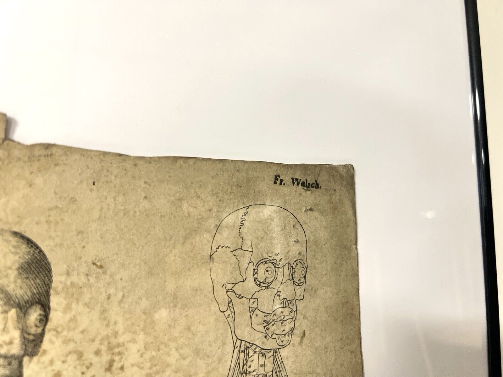 Dr Munz Fecit, A 19th Century Anatomical Etching